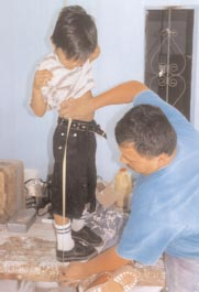 Armando, en Coyotitán, mide a un niño para las DAFOs de sus tobillos, para ayudar a que extienda sus piernas.