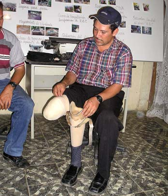 Santos Barrientos perdió su pierna con una mina terrestre 8 años después del final de la Guerra Contra.