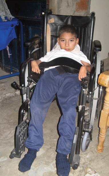 Las sillas de ruedas para adultos de gran tamaño con niños que se deslizan fuera de ellas, como este niño, son muy comunes en Colombia y en muchos países que he visitado.
