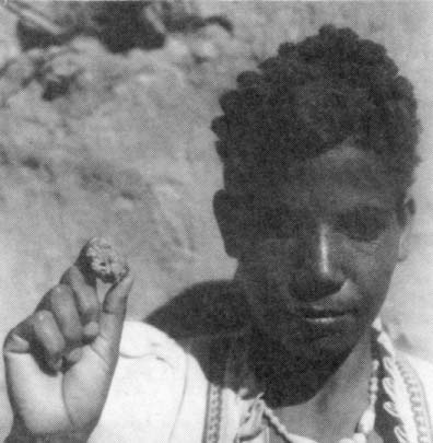 Village health worker in Beni Suet holds a piece of kishk neshif possibly the most appropriate local basis for oral rehydration therapy.