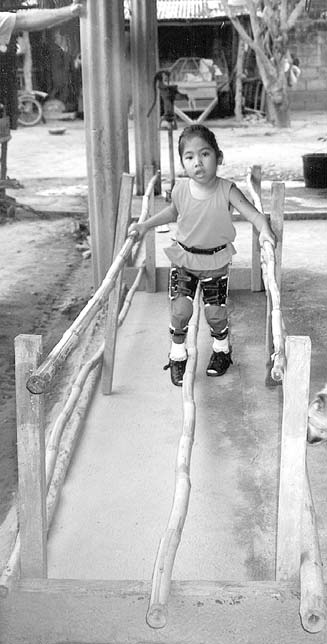 A bamboo pole between the feet of this girl in the Philippines helps to keep her legs from scissoring.