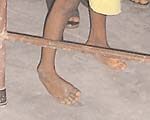 Kiran’s feet on a flat surface, showing curvature.