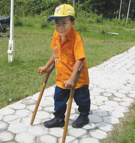 Ocu with his new hand-made crutches.