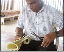 A helpful local carpenter cut strips of foam plastic, glued them inside the splits as padding, and neatly trimmed the edges. The finished splints looked quite professional, but were made on the spot, with help from the child, his mother, and volunteer workers, at almost no cost.