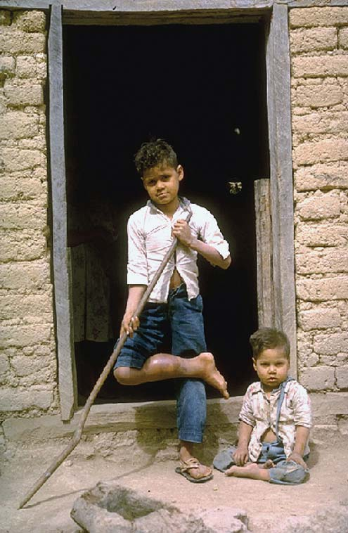 Marcelo at 3 years old sitting in front of his family house in Caballo de Arriba with his brother, who injured his leg.