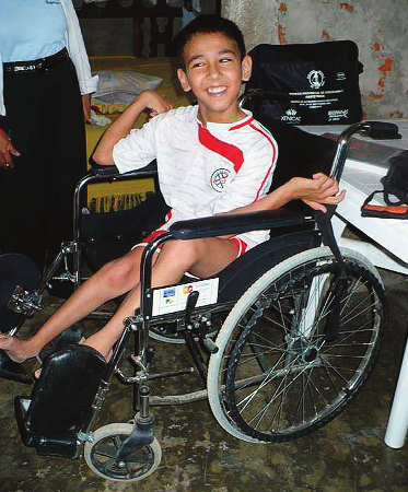 Jeferson’s uncontrolled movements made it hard for him to stay seated in his wheelchair.