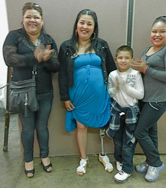 With her family a woman shows off her new prosthetic leg.