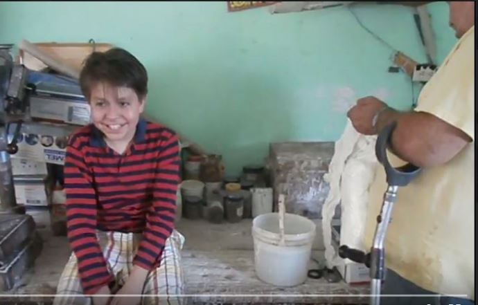 Tomás felt at ease with the PROJIMO shop-workers. Here he waits as Inez prepares to cast his foot for a brace.